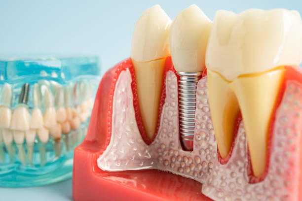 Best Cosmetic Dentistry  in Premont, TX